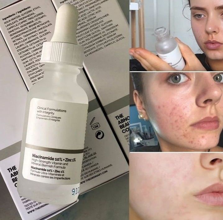 THE ORDINARY Acide Hyaluronique 2% + B5 (avec Céramides) 30 ML – Image 5